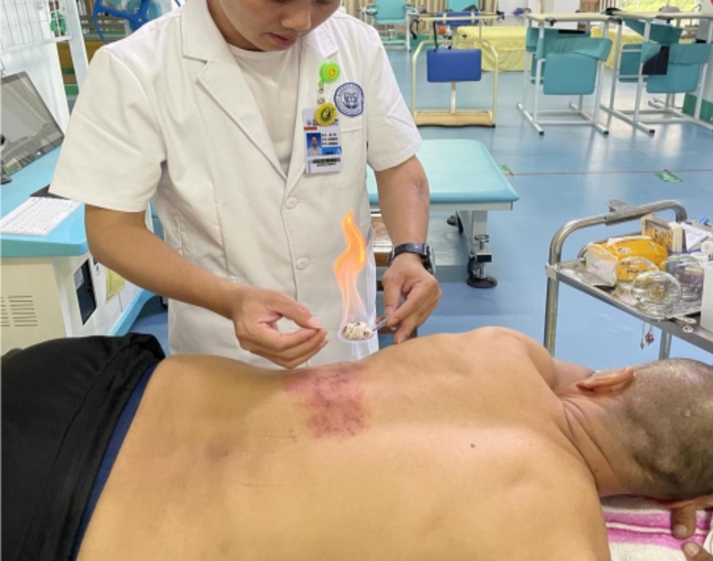 火针灸疗法.jpg 05a9c975b45745968ce426092f4ed5bd.jpeg
